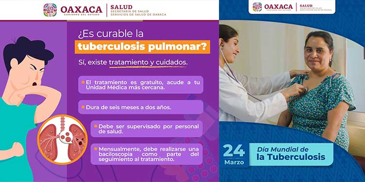 Tuberculosis Enfermedad Curable Si Se Trata A Tiempo Prensa Digital